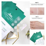 VT Cica Acne Spot Patch - Fanxi Life