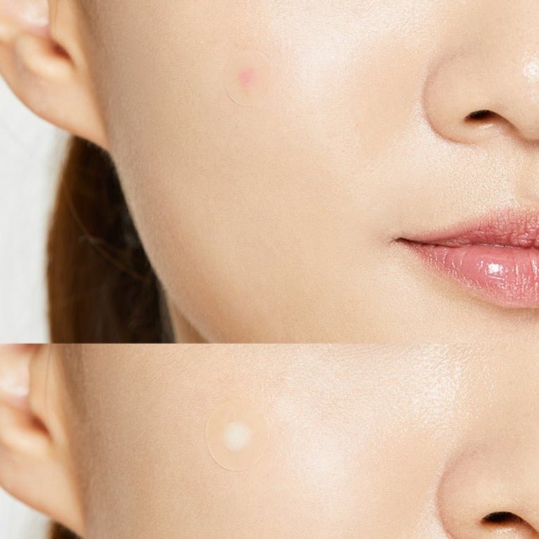 COSRX Acne Pimple Master Patch (24 Patches) - Fanxi Life