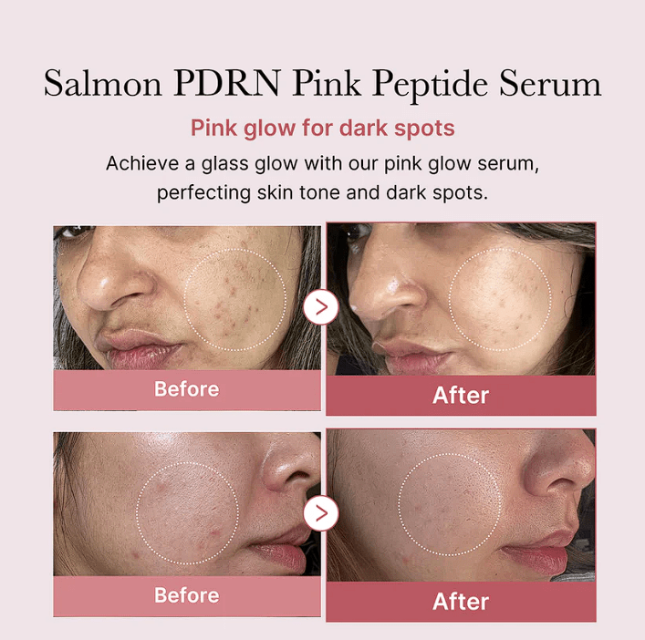 Medicube PDRN Pink Peptide Serum (30ml) - Fanxi Life