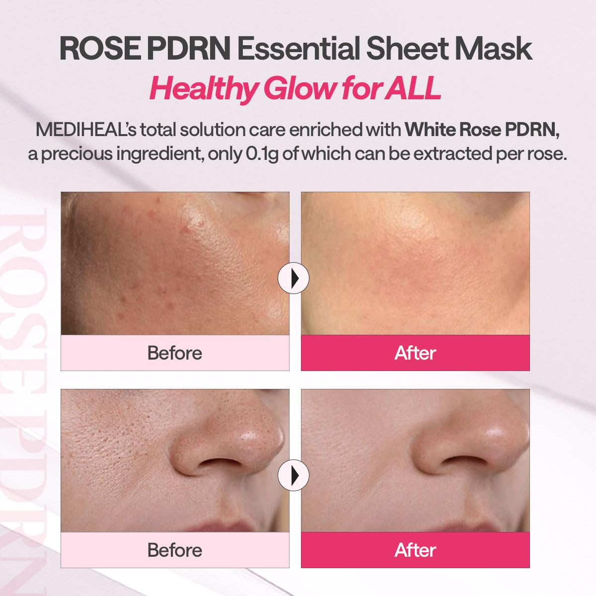 MEDIHEAL Rose PDRN Essential Mask (10 PCs) - Fanxi Life