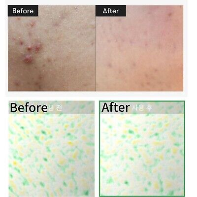 VT Cica Reedle Shot 100 Essence (50ml) - Fanxi Life